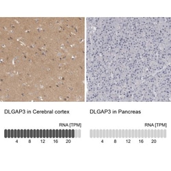 DLGAP3 Antibody, Novus Biologicals 0.1mL; Unlabeled:Antibodies, Polyclonal